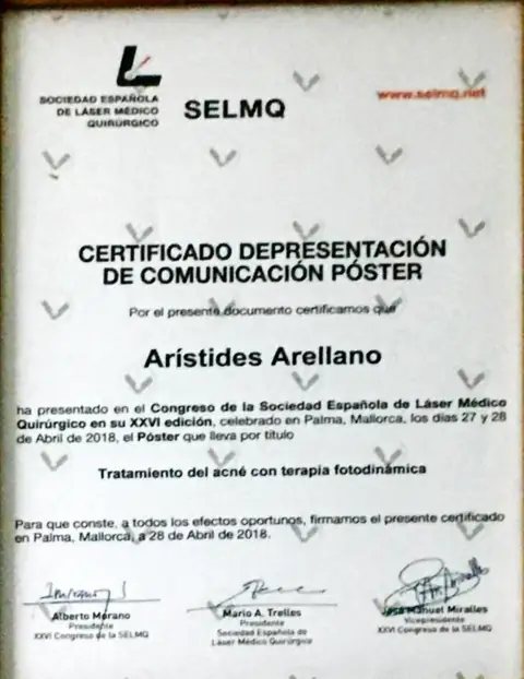 Póster: tratamiento del acné con terapia fotodinámica — XXVI SELMQ — Palma de Mallorca · 27–28 de abril de 2018